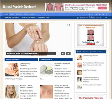 Natural Psoriasis Treatment Pre-made Niche Website/Blog