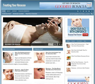 Treating Your Rosacea Pre-made Niche Website/Blog