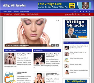 Vitiligo Skin Remedies Pre-made Niche Website/Blog