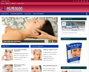 Acne Pre-made Affiliate Niche Website/Blog